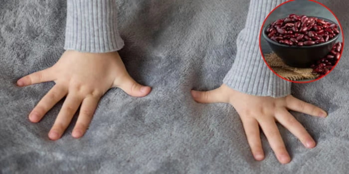 Niña de 3 años murió asfixiada con frijol: congestión impidió ser auxiliada