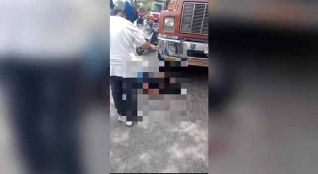 Posible Amputación por accidente de tránsito