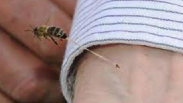 En la UCI se encuentra una de las personas que fue picada por una abeja