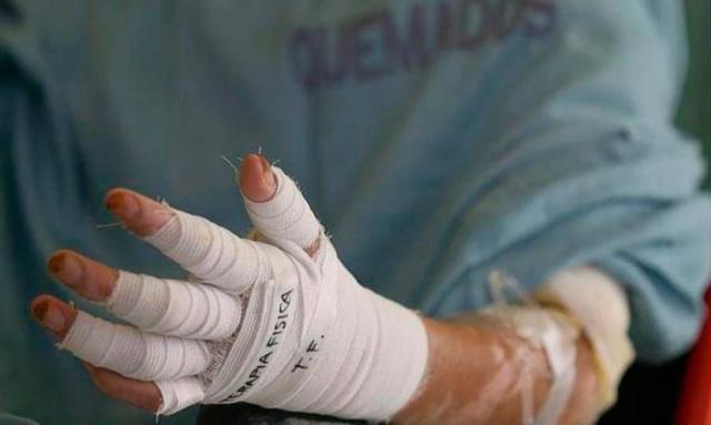 Ya se presentan los primeros quemados con pólvora en Santander, un niño y un adulto