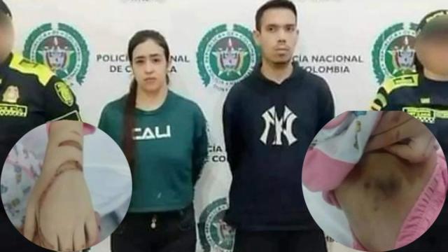 Aberrante, niños de 4 y 5 años eran amarrados y quemados por su madre y padrastro, fueron capturados