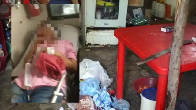 Indignante, hijo, atacó a machete a su mamá, la dejó sin oreja y nariz.