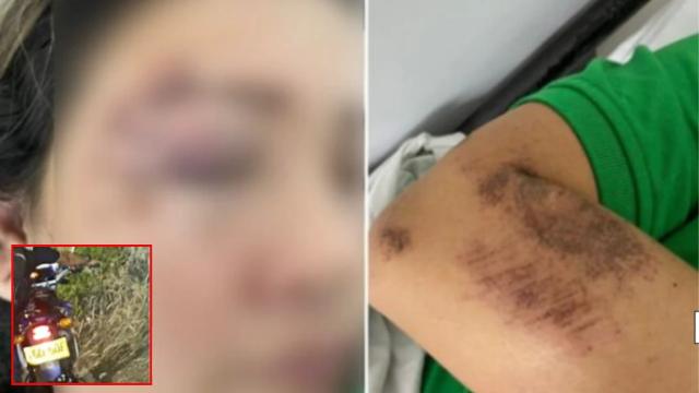 Mujer quedó tirada y herida en la autopista tras brutal accidente, pidió un servicio de ‘moto’ por aplicación