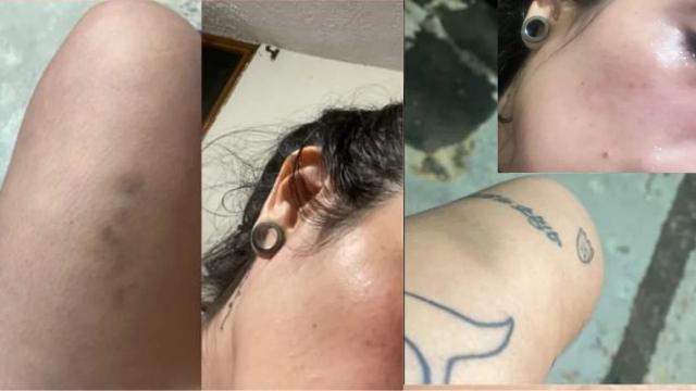 Joven fue agredida por conductor en un caso en intolerancia en Floridablanca