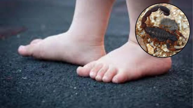 Tragedia: niño de 2 años falleció tras picadura de alacrán