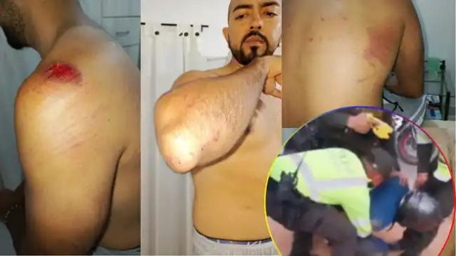 Video: Motociclista denuncia agresión de policía de tránsito en Floridablanca
