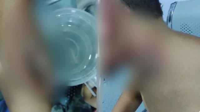 Tres personas quemadas por pólvora en el Área Metropolitana de Bucaramanga durante la noche de velitas