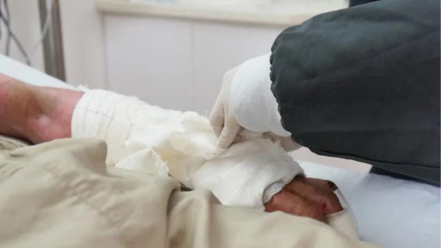 Explosión en fábrica ilegal de pólvora dejó a joven gravemente herida