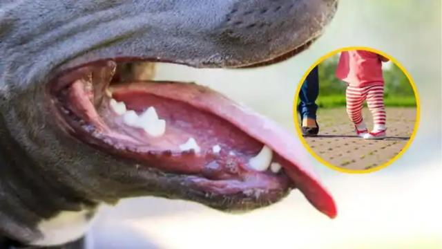 Menor de dos años fue mordida en el rostro por un Pitbull en Bucaramanga