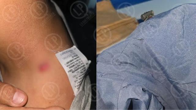 Mientras  comia una empanada joven fue atacado por un desconocido. Ya le habian decomisado varios cuchillos