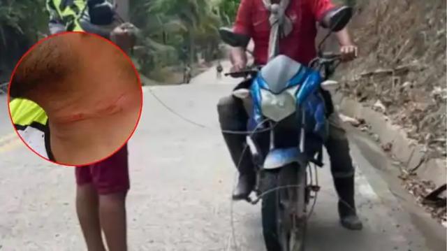 Motociclista casi pierde la vida por una cuerda colgante en una vía