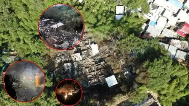 Una de las personas quemadas en Incendio en el 12 de Octubre sufrió amputación