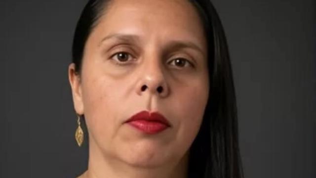 Mujer perdió una mano y sufrió graves heridas tras brutal ataque en una vivienda