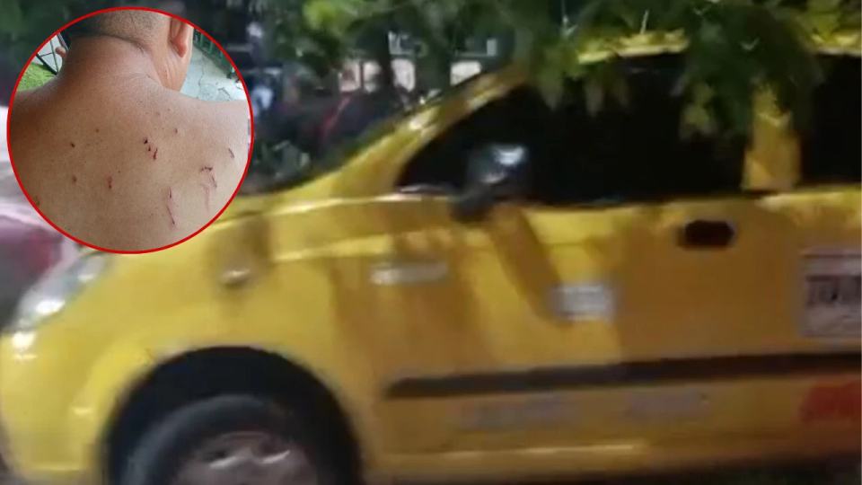 Taxista fue brutalmente atacado a puñal, le propinaron 14 puñaladas en un intento de robo en Santander