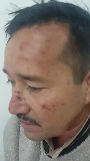 Conductor de una turbo fue golpeado y atracado en la vía a Vélez. - imagen 3