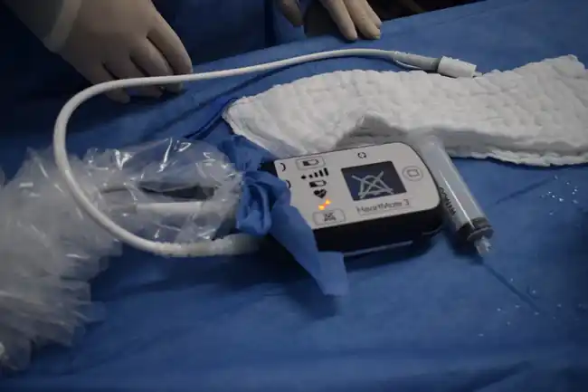 Investigación en corazones artificiales desde Santander alcanza reconocimiento global - imagen 2