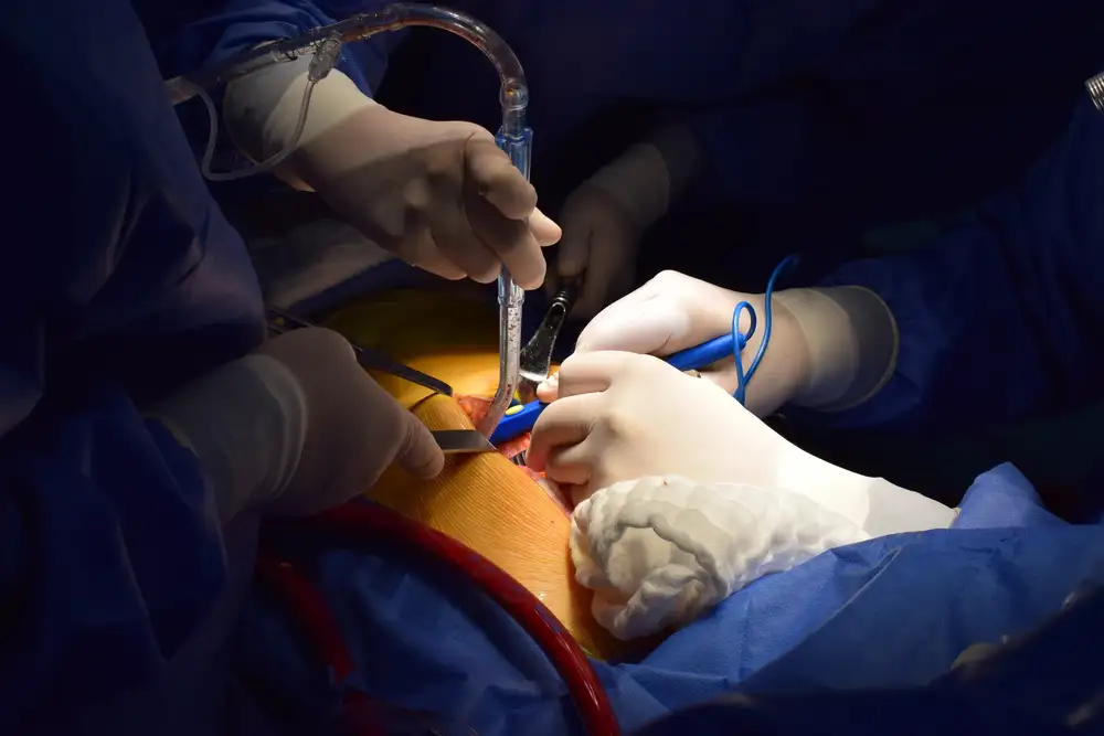 En Santander está el hospital que realiza más trasplantes de corazón en el país - imagen 2